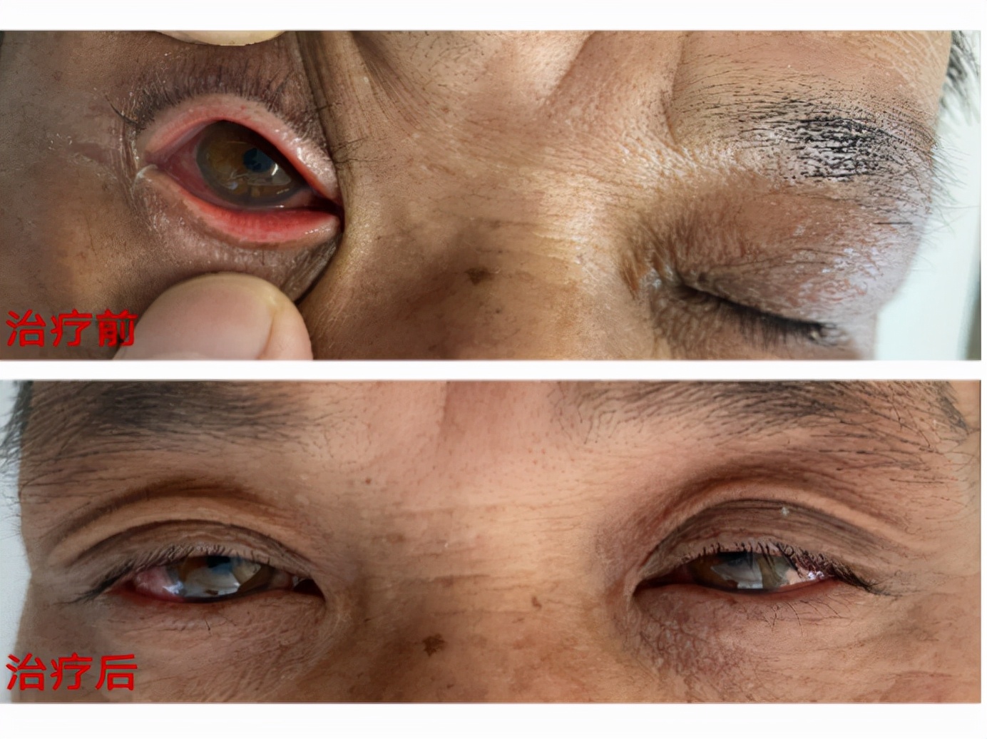 仁心妙术播撒光明,仁心妙术