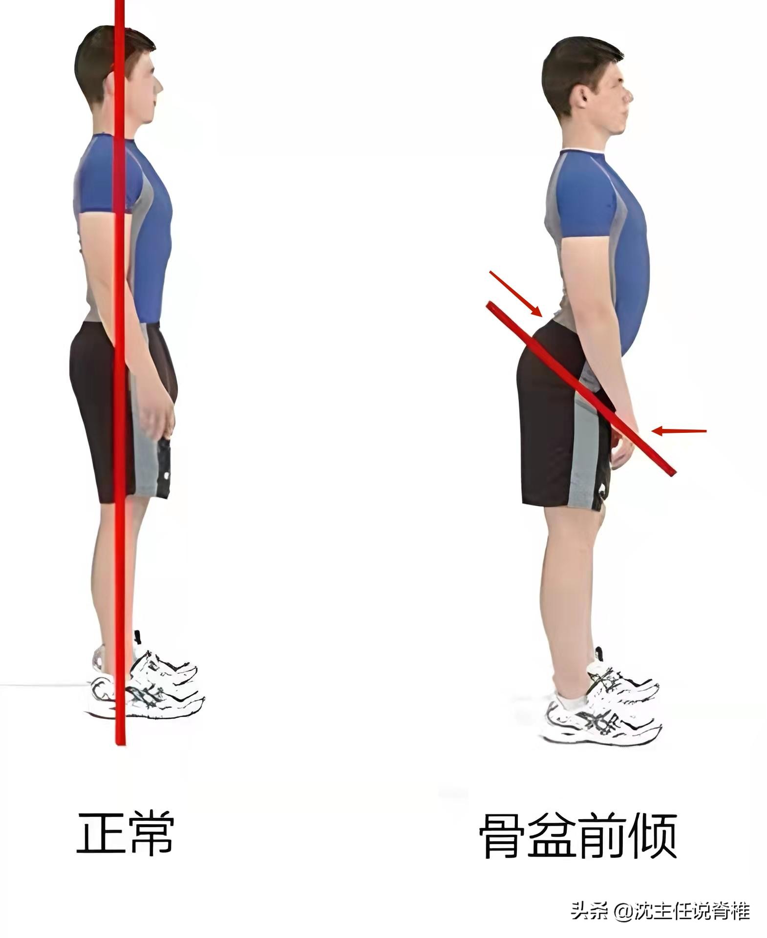 人不胖但肚子变大是怎么回事,肚子大怎么练都不小怎么回事