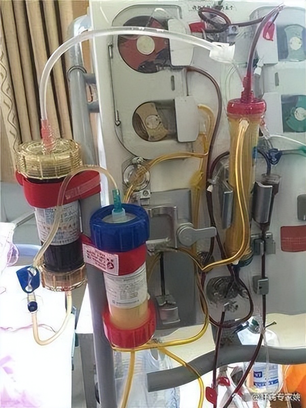 中药调理肝硬化肝功能正常,肝硬化引起的肝衰竭怎么办