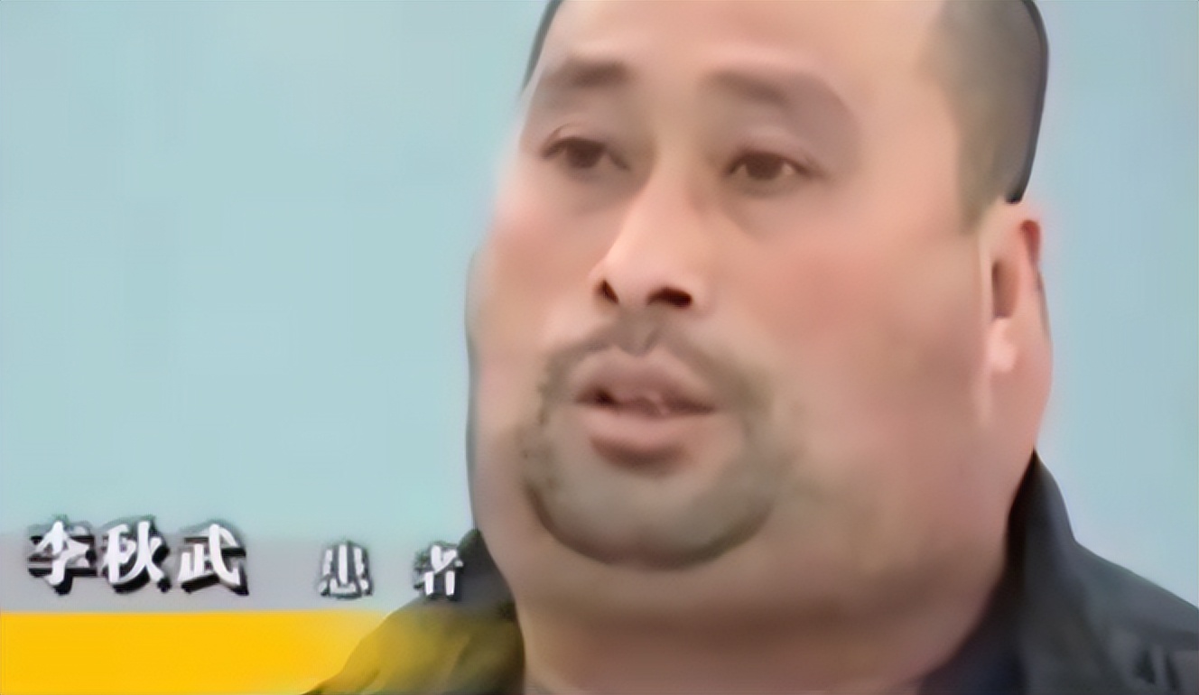 男子一年喝一千斤酒膀子像河马,男子喝酒脖子变河马脖