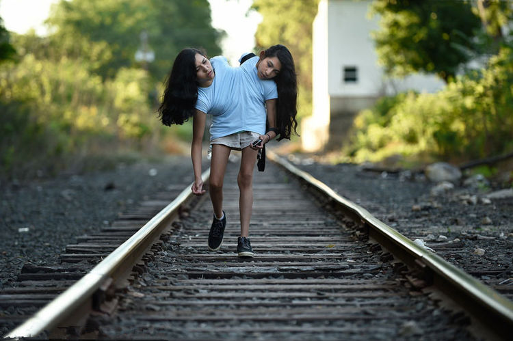 连体姐妹一人结婚现在如何,雌雄连体人结婚怎么办