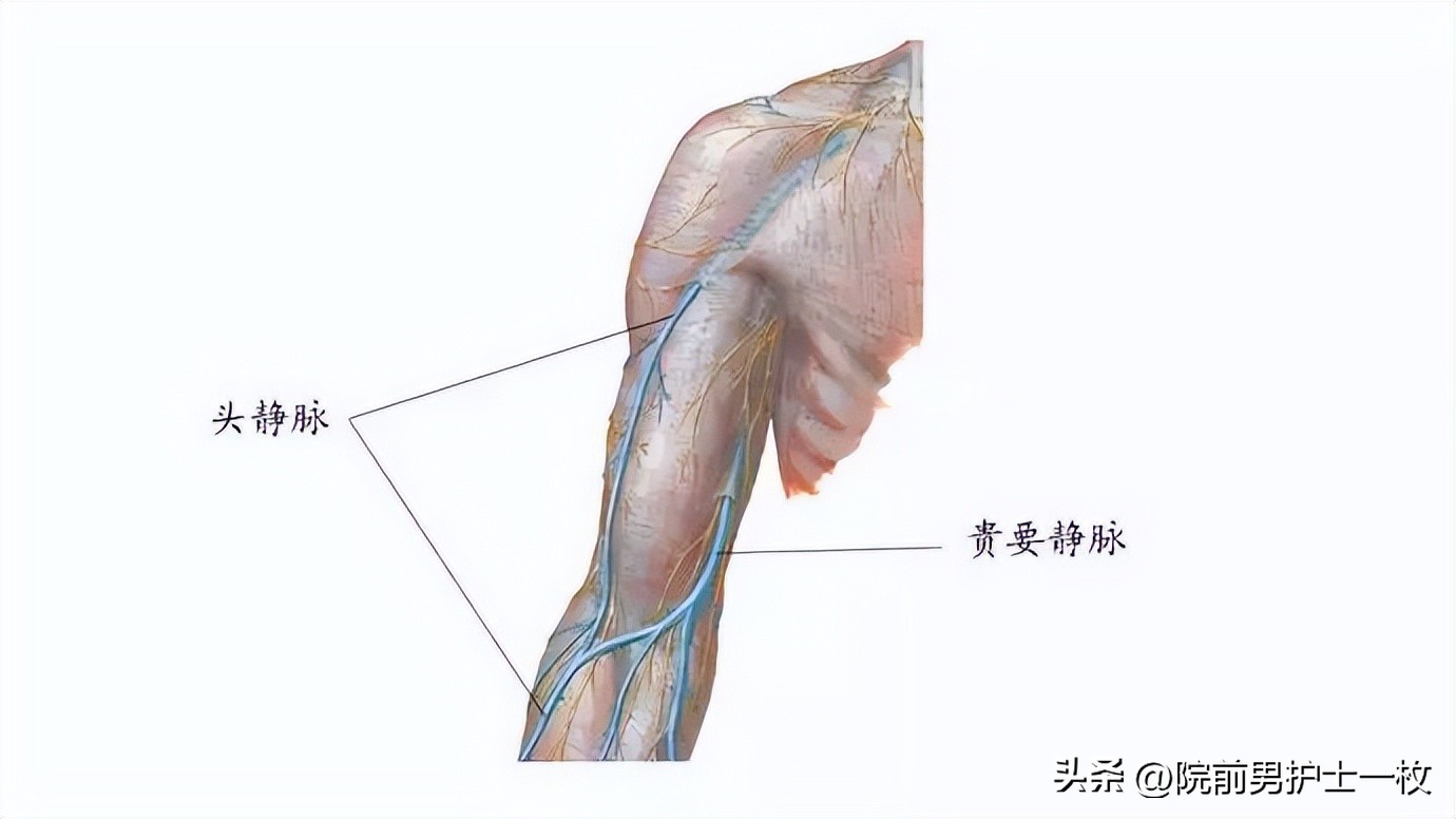 picc置管技术大全,picc置管操作流程