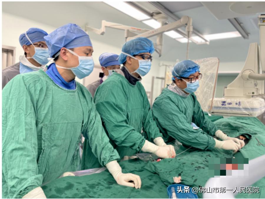 新技术！佛山首例重建髂内动脉术让腹主动脉瘤治疗不用“弃车保帅”了