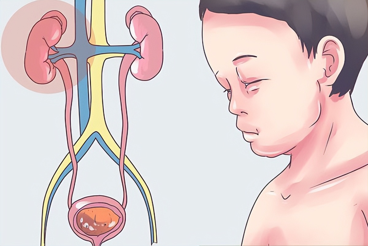 儿童肾病综合征蛋白尿吃啥中药好,男孩有肾病怎样治疗