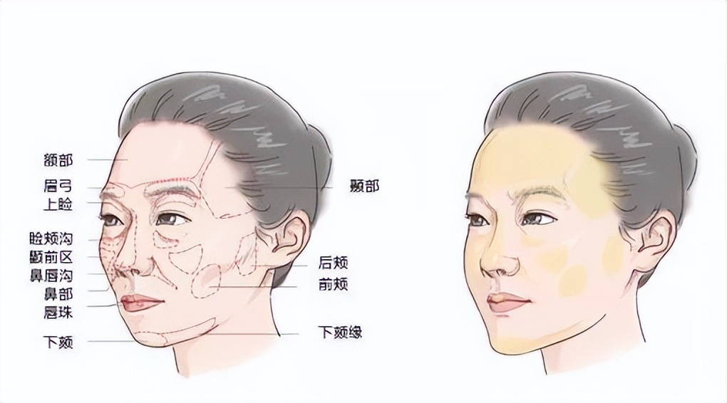 九院韦敏修复眼睛,九院韦敏手术案例