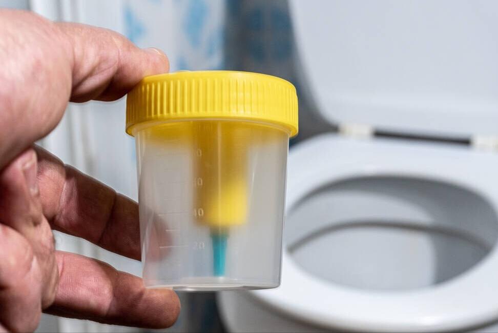 肾脏损伤尿量减少原因,尿量减少身体出现什么症状