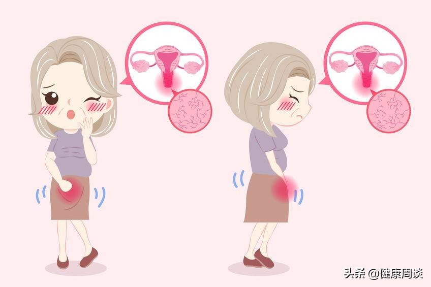 提醒女性：若不想被妇科病“缠上”，需牢记这3件事！
