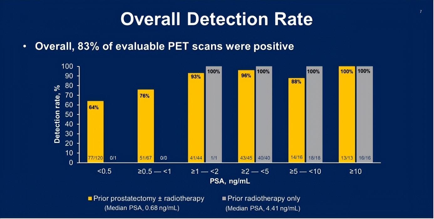 董柏君微创治疗前列腺癌,董柏君泌尿科专家