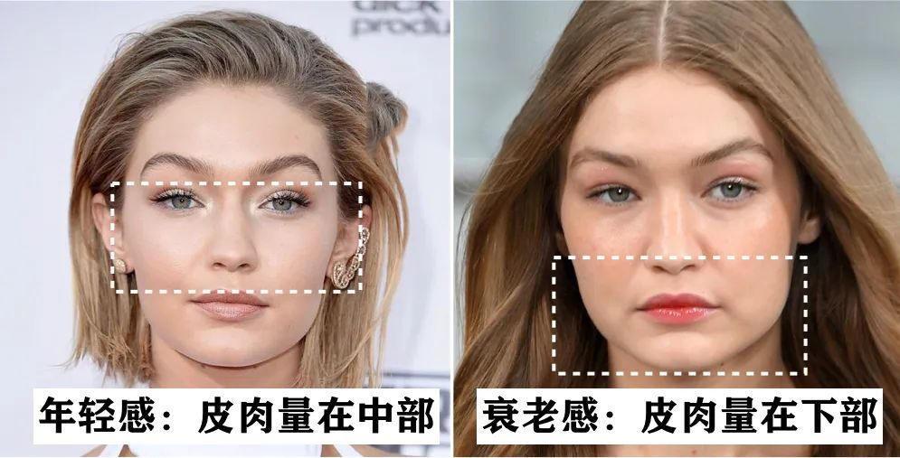 发腮和塌腮哪个更显老,发腮真的显老吗