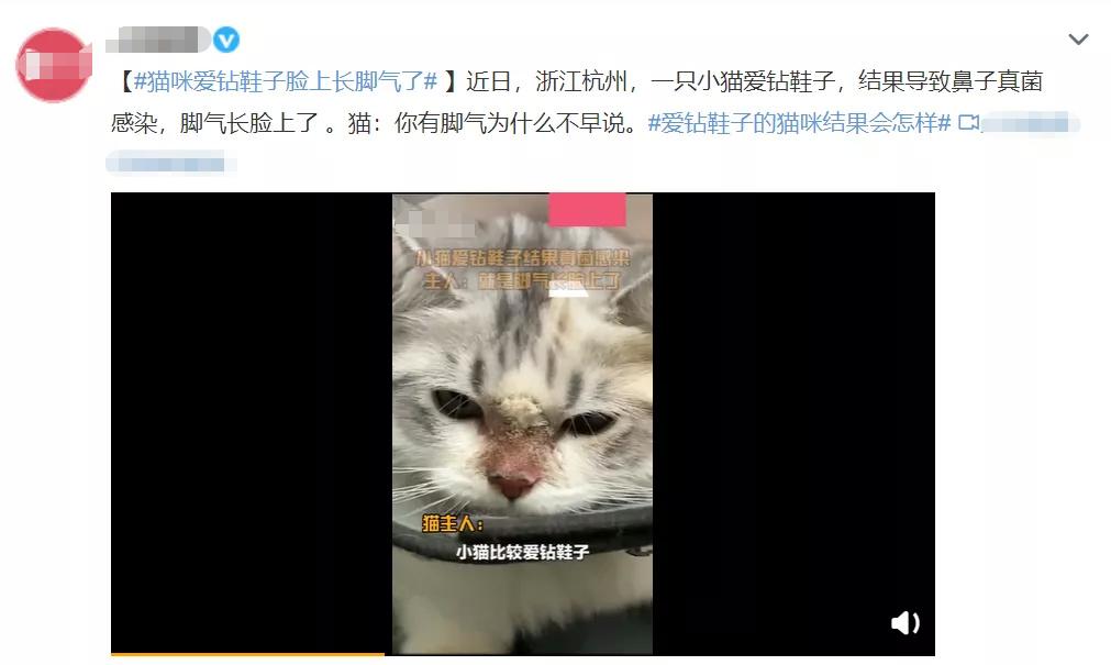 肚脐眼的黑泥到底可不可以抠,人体的秘密全部视频