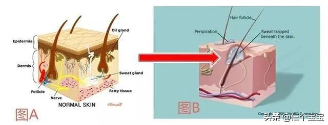 天气再热不能给孩子穿什么,孩子夏天特别热需要擦痱子粉吗