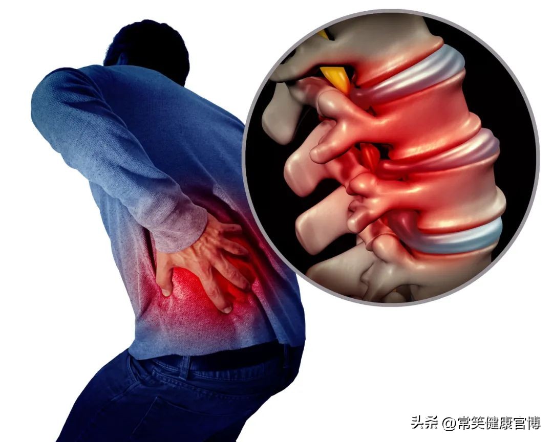 坐骨神经痛要用什么特效药治,坐骨神经痛用什么特效药最好