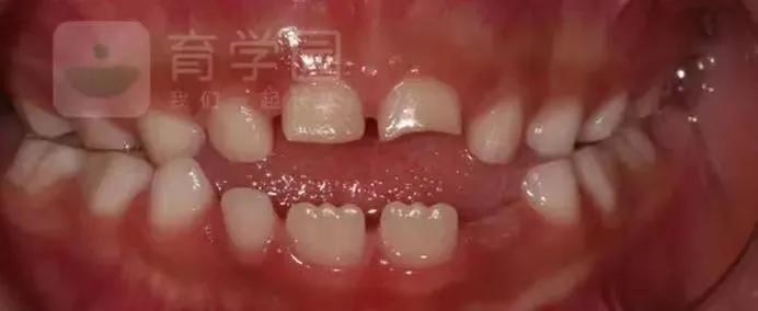 这五个坏习惯真的会让孩子变丑,这些小习惯让你变丑