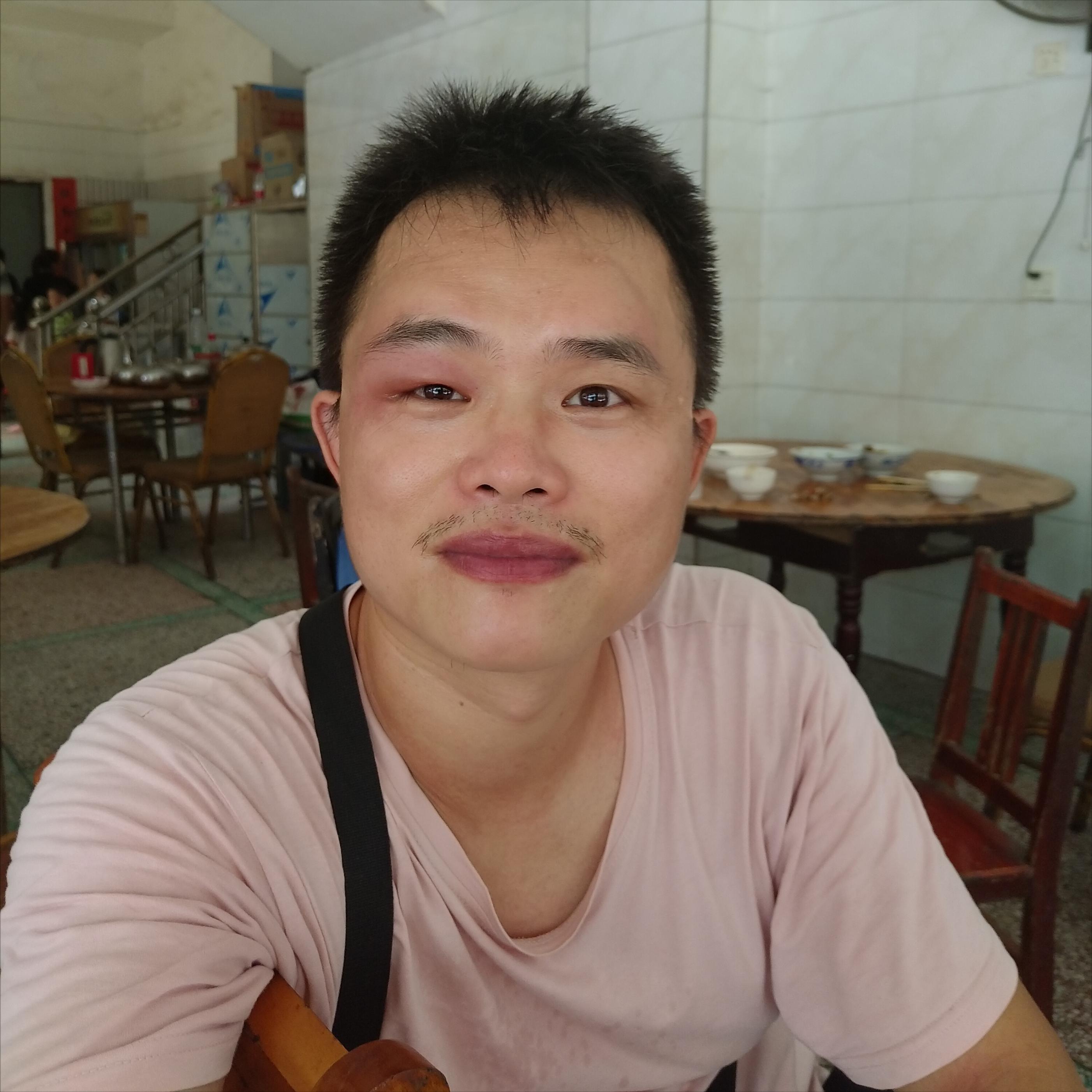 第一次被蜜蜂蛰是怎样的感觉,额头被蜜蜂蛰了没什么大的感觉