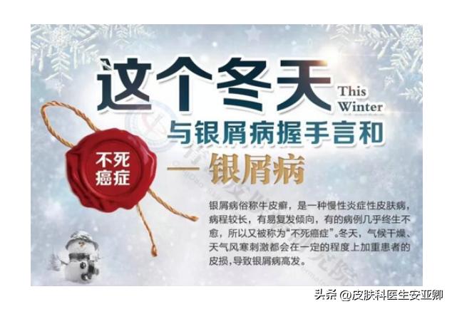 银屑病小腿红肿用什么药,银屑病关节肿痛怎么办