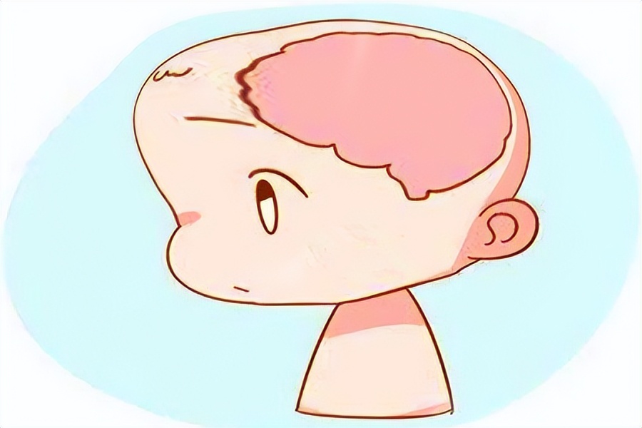 先天性脑积水能坚持多久,成人先天脑积水有必要治疗吗