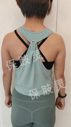 颈椎间盘突出压迫桡神经怎么恢复,颈椎间盘突出压迫手指麻怎么治疗