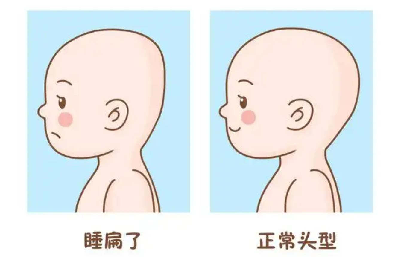 娱乐圈扁头发型,娱乐圈的扁头盘点