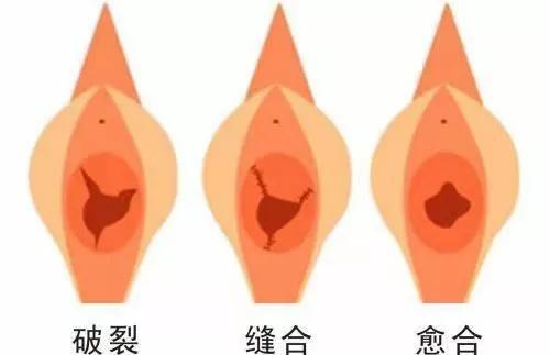 “私密整形”都包括哪些部位?