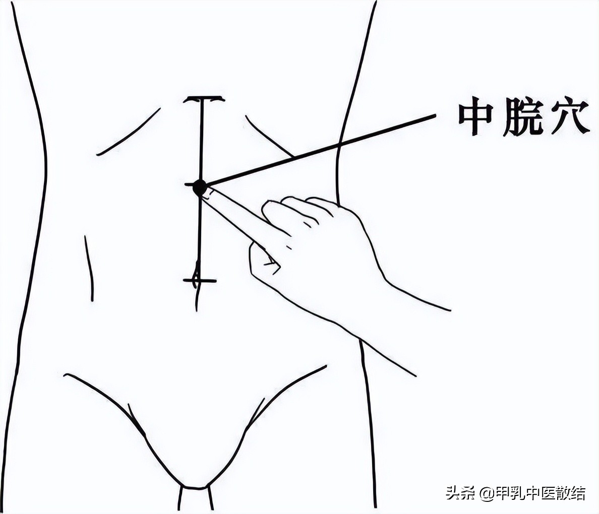 人体祛湿哪些中成药比较好,人体两大祛湿器官