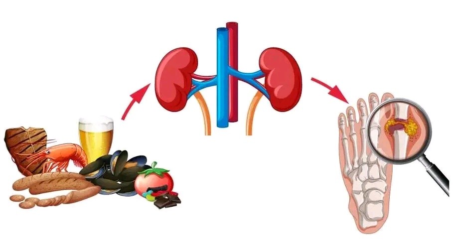 吃非布司他多久能有效降尿酸,反复吃非布司他降尿酸可以吗