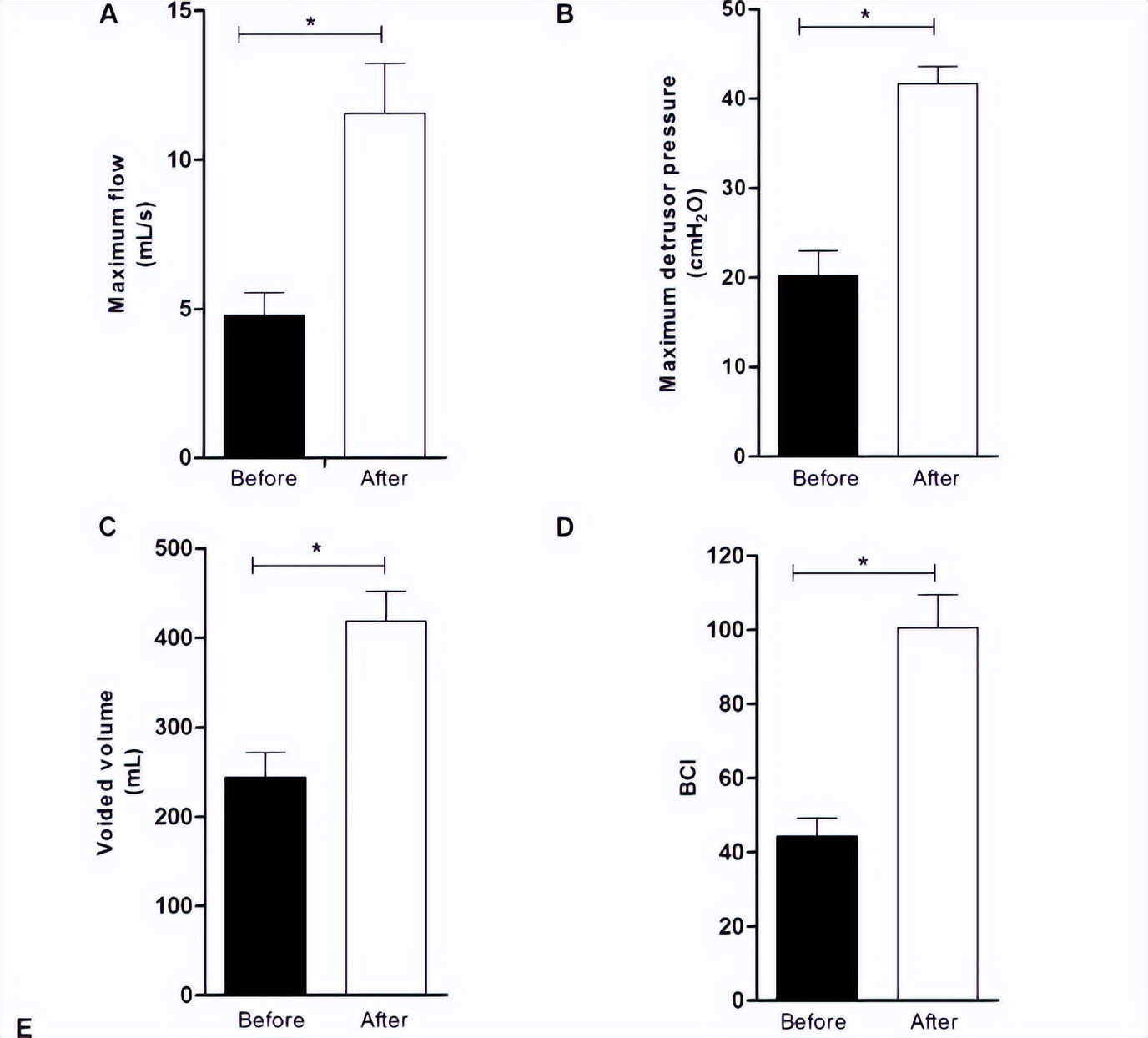渐冻症腰椎手术报道,渐冻症患者寿命长的视频