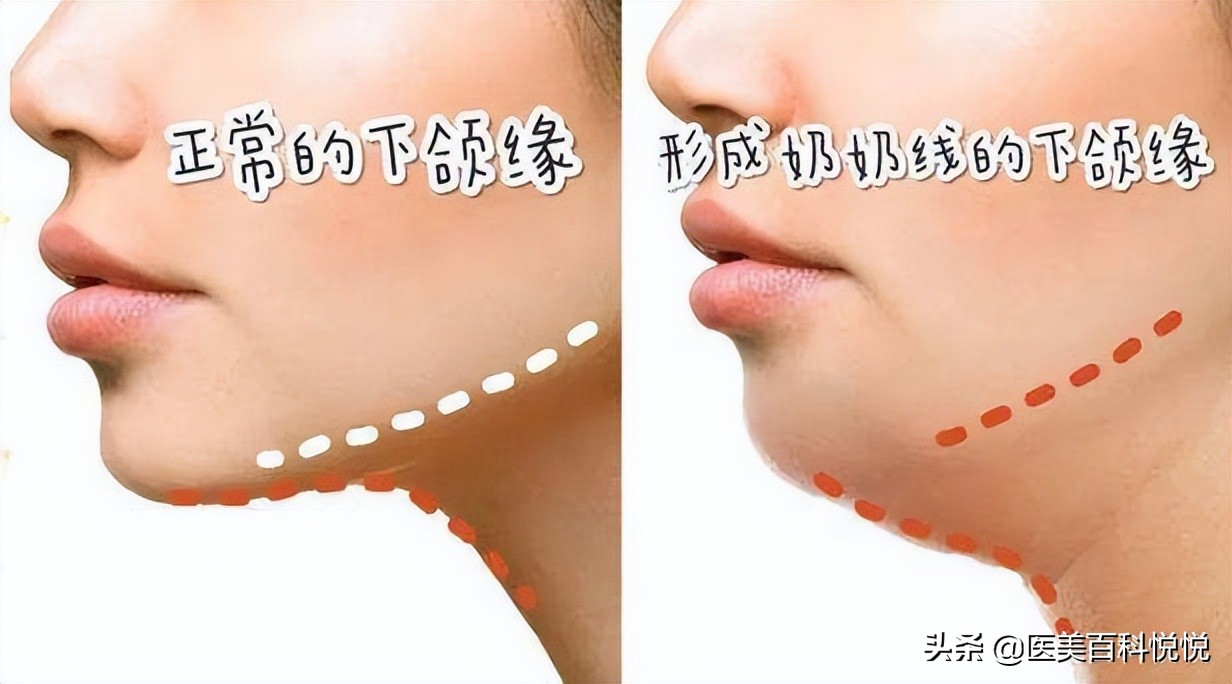 江苏苏王——如何让侧脸变得好看？你的侧脸合格了吗？