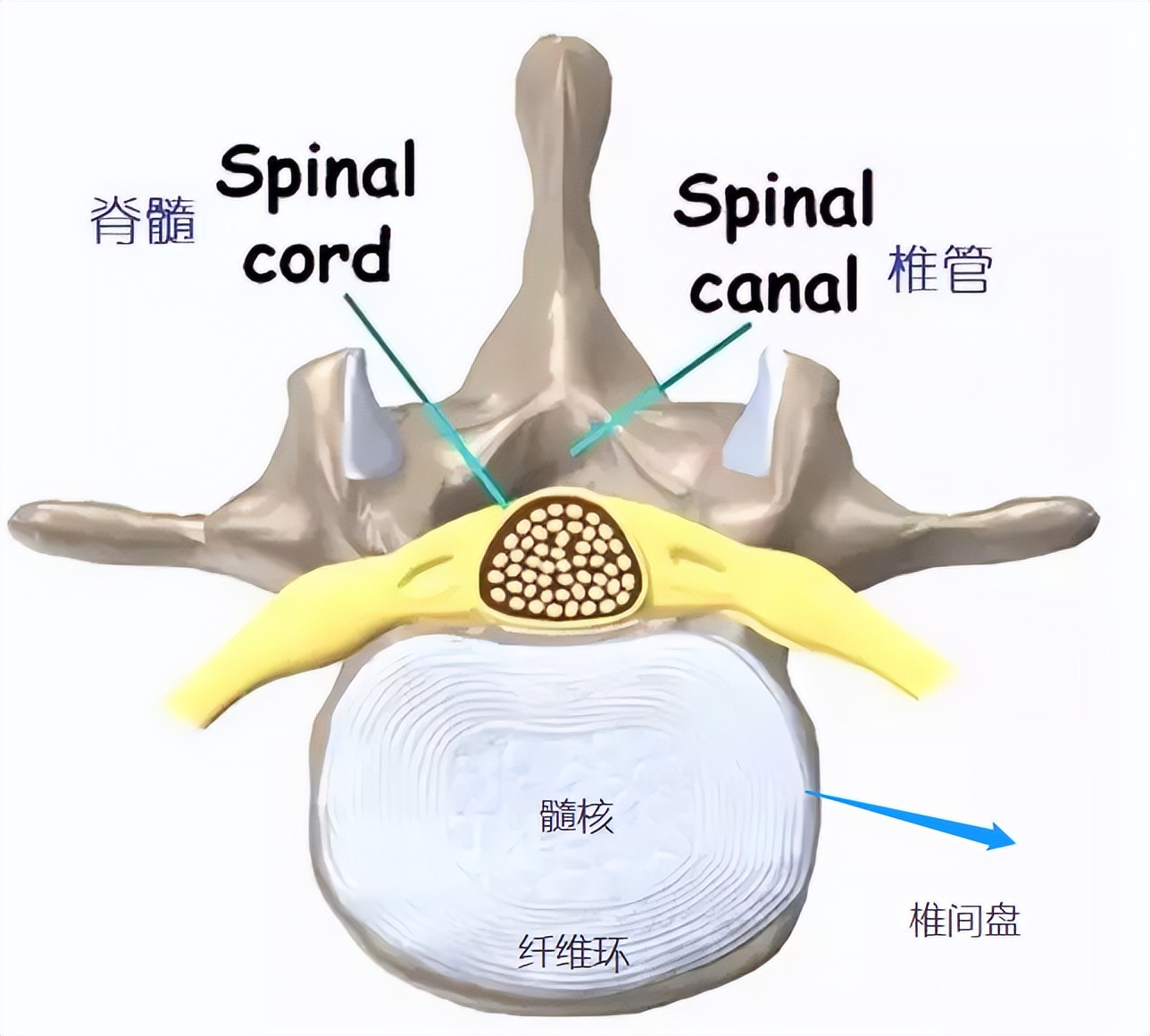 腰椎间盘核磁信号,腰椎间盘突出中央型核磁如何描述