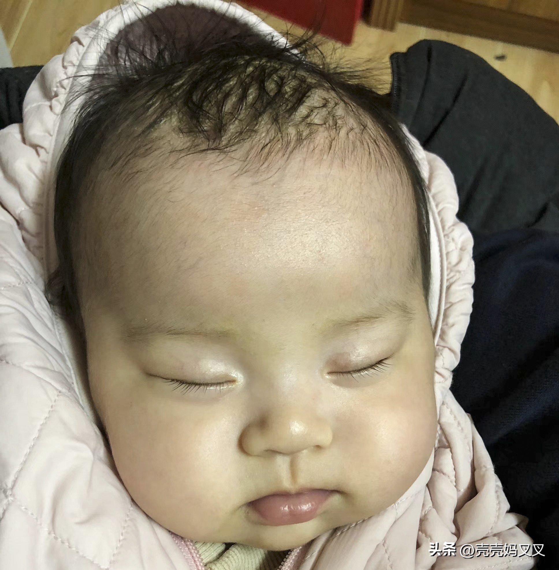 宝宝头皮奶痂用手抠了没事吧,千万不要用你的手去抠宝宝头垢