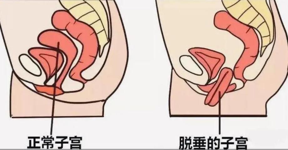 40岁女性漏尿是什么原因,40岁女性偶尔漏尿怎么回事