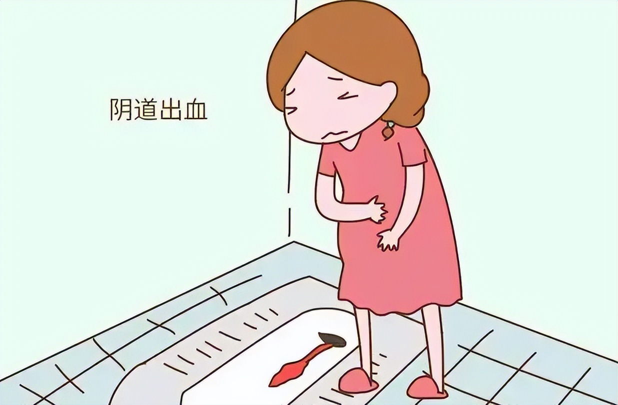 浪哥门诊日记：抽空，给大家讲一下宫外孕与阴道出血的关系