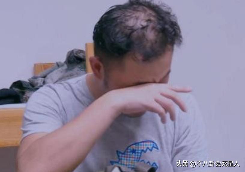 脸部垮掉的男人,脸部塌陷的男生