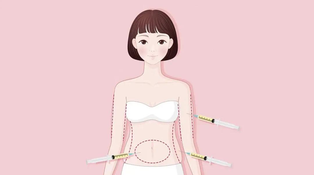 九院韦敏隆鼻相关科普第二期,九院韦敏手术案例