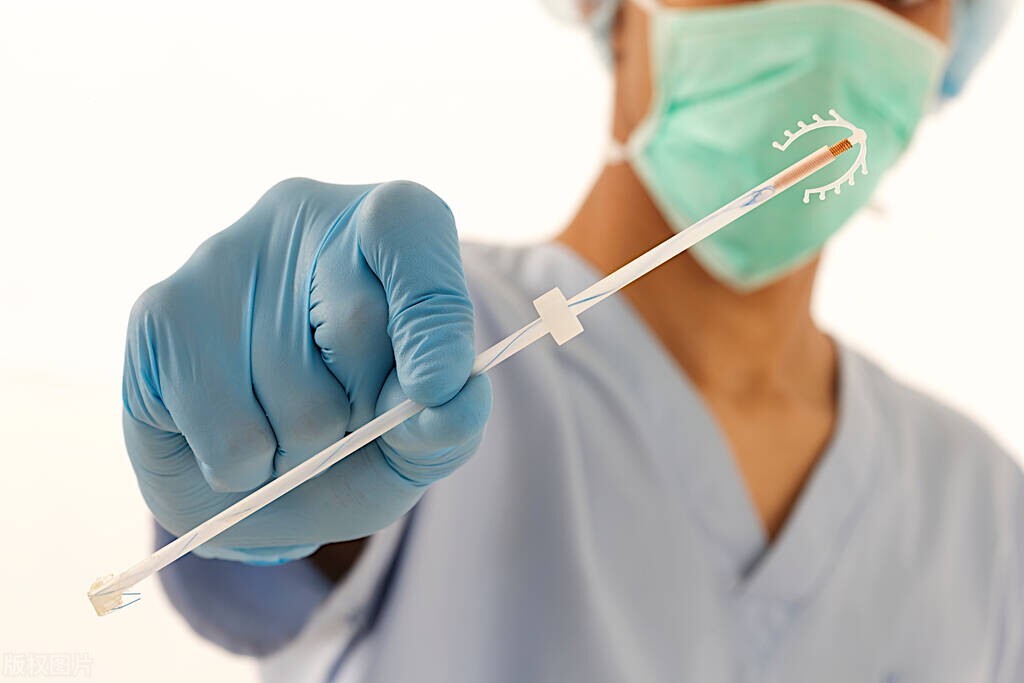 女性取了节育环后该注意哪些问题,女性把节育环取了应该注意啥