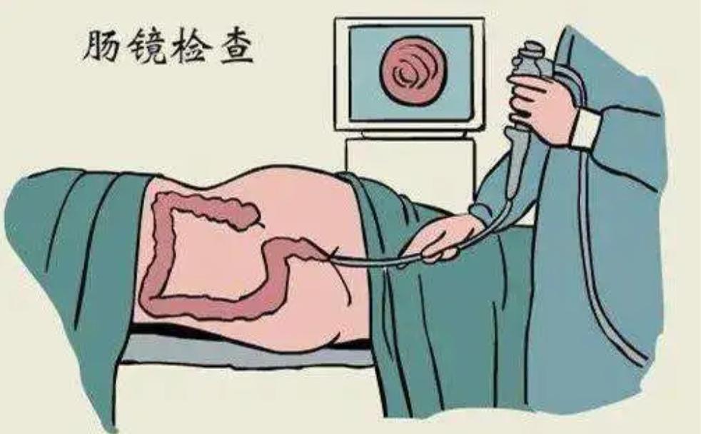男医生做肠镜检查吗,男医生做肠镜会难为情不