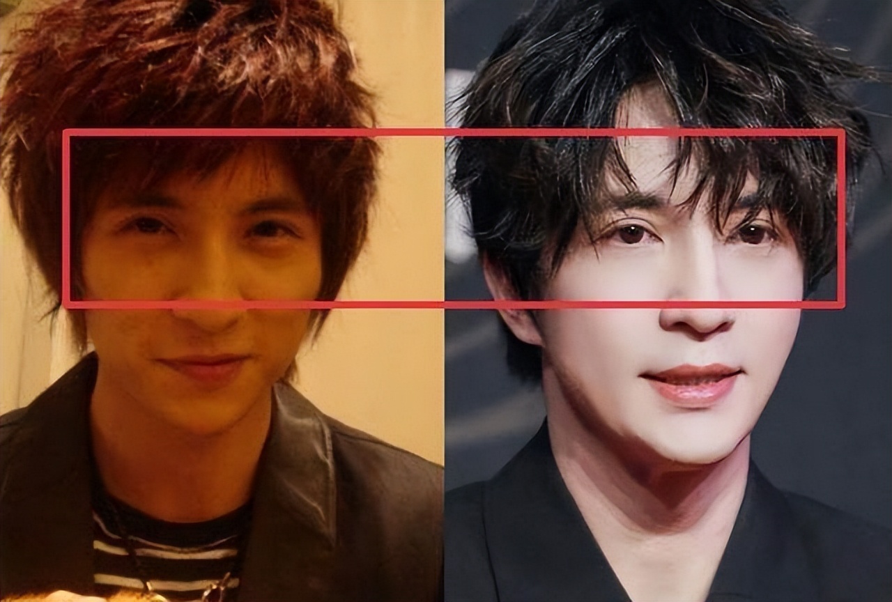 都有哪些男明星做过双眼皮,男明星做双眼皮的有哪些