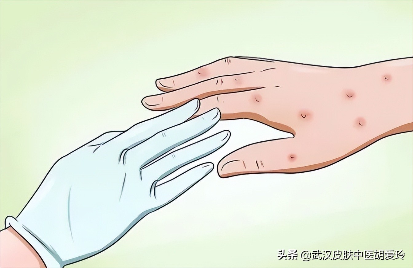 胳膊上长水泡并且疼痛难忍，这边的耳朵也有点嗡嗡作响