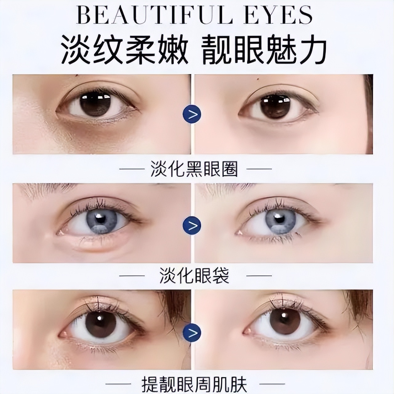 抗皱又好吸收的眼霜,女人都需了解的5款贵妇眼霜