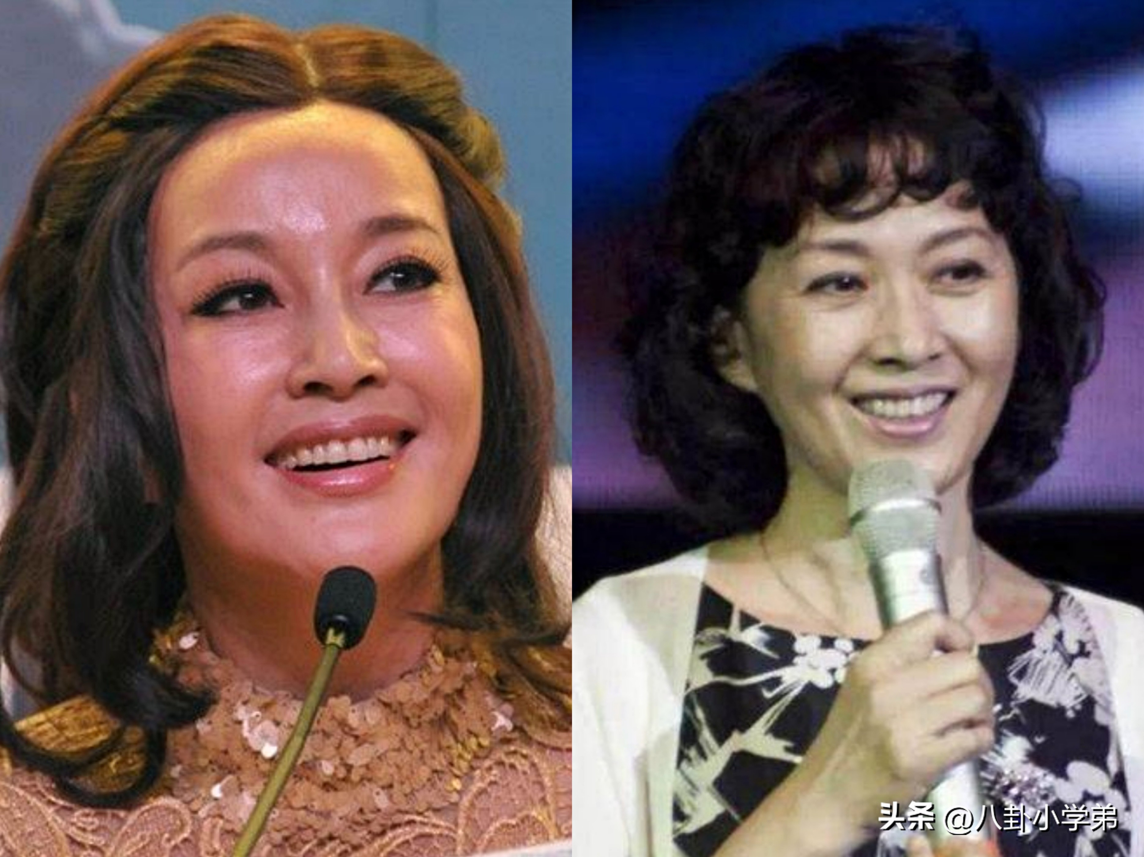 整形脸和真正的美人区别,整形变美的对比图片