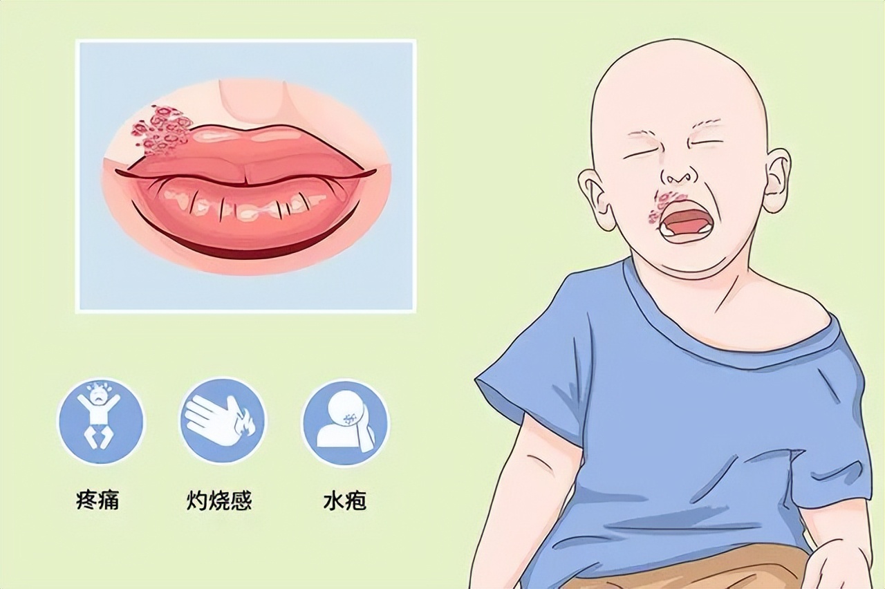 嘴上出了好多透明水泡会传染吗,嘴上起水泡是什么原因传染吗