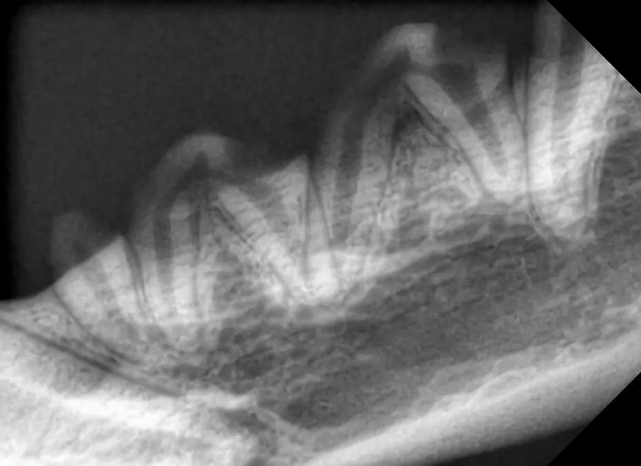 牙釉质发育不全能矫正吗,牙釉质发育不全怎么补救