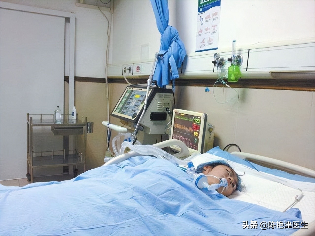 年轻妈妈妊娠纹严重的肚子照片,13岁女孩肚子爬满妊娠纹吓到妈妈