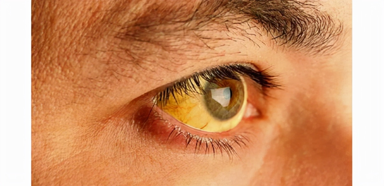 口干口苦口臭是有病吗,口干口苦口臭是脾胃不好吗