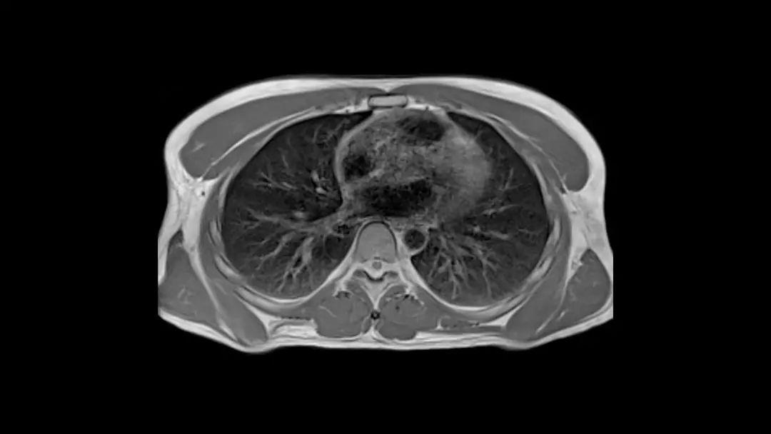 西门子医疗有什么强项,西门子医疗价格