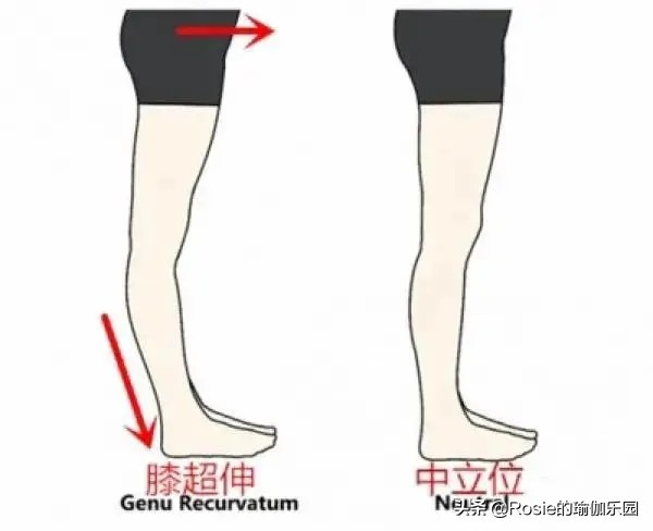 如何把小腿和大腿瘦得很好看,如何瘦大腿和小腿动作图解