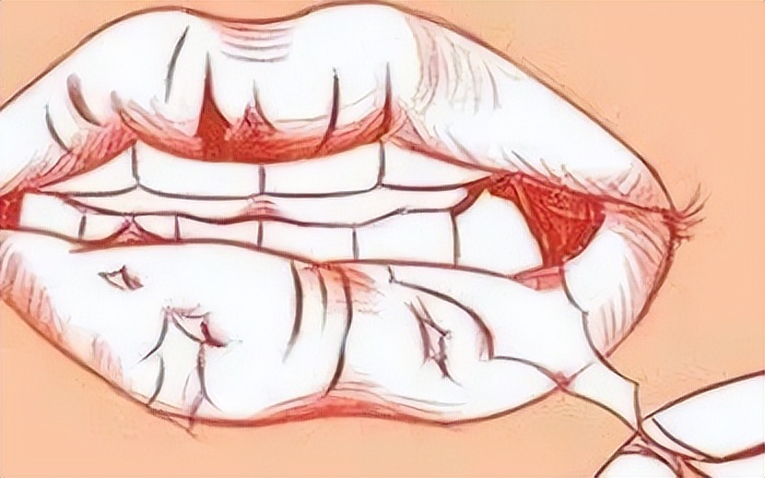 一入秋就舔嘴唇,一换季就爱流鼻血