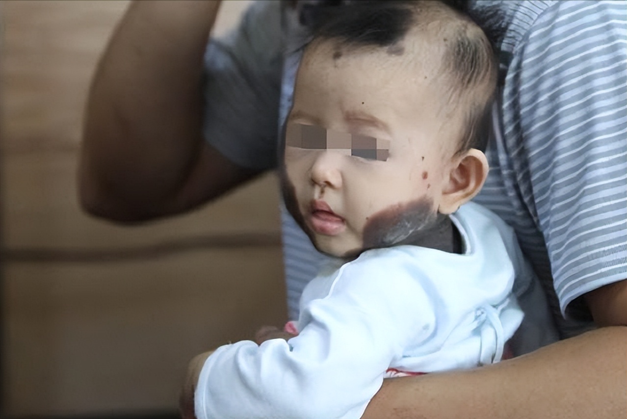 福建孕妇吃老鼠孩子长满黑斑,男子给怀孕的妻子吃竹鼠