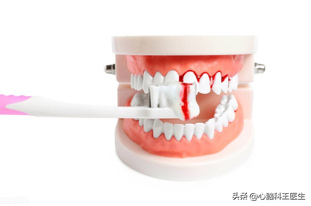 吃阿司匹林引起牙出血要停服吗,吃阿司匹林引起肠道出血吗