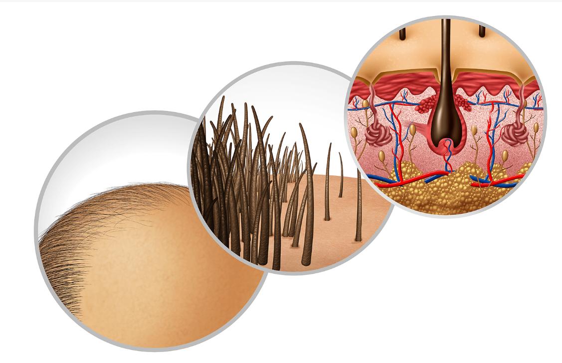 头顶白发什么原因如何根治,白头发怎么调理白发最多