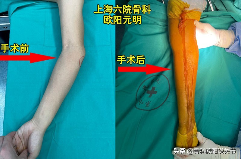 名医讲述滑膜炎,名医专访骨科医生